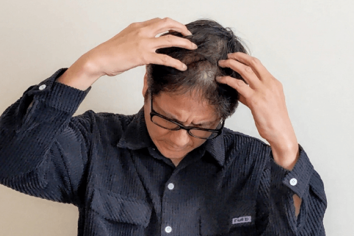 髪の毛を気にする男性